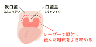 図解