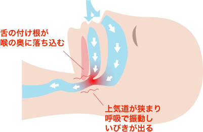 図解