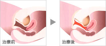 図:治療前後